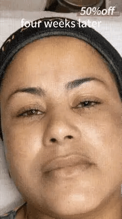 Bikenda™ Blemish Removing Beauty Cream 44 Bikenda™ Blemish Removing Beauty Cream